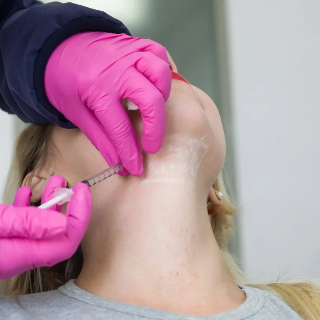 Kybella Treatment at Skin MD in Woodstock, GA