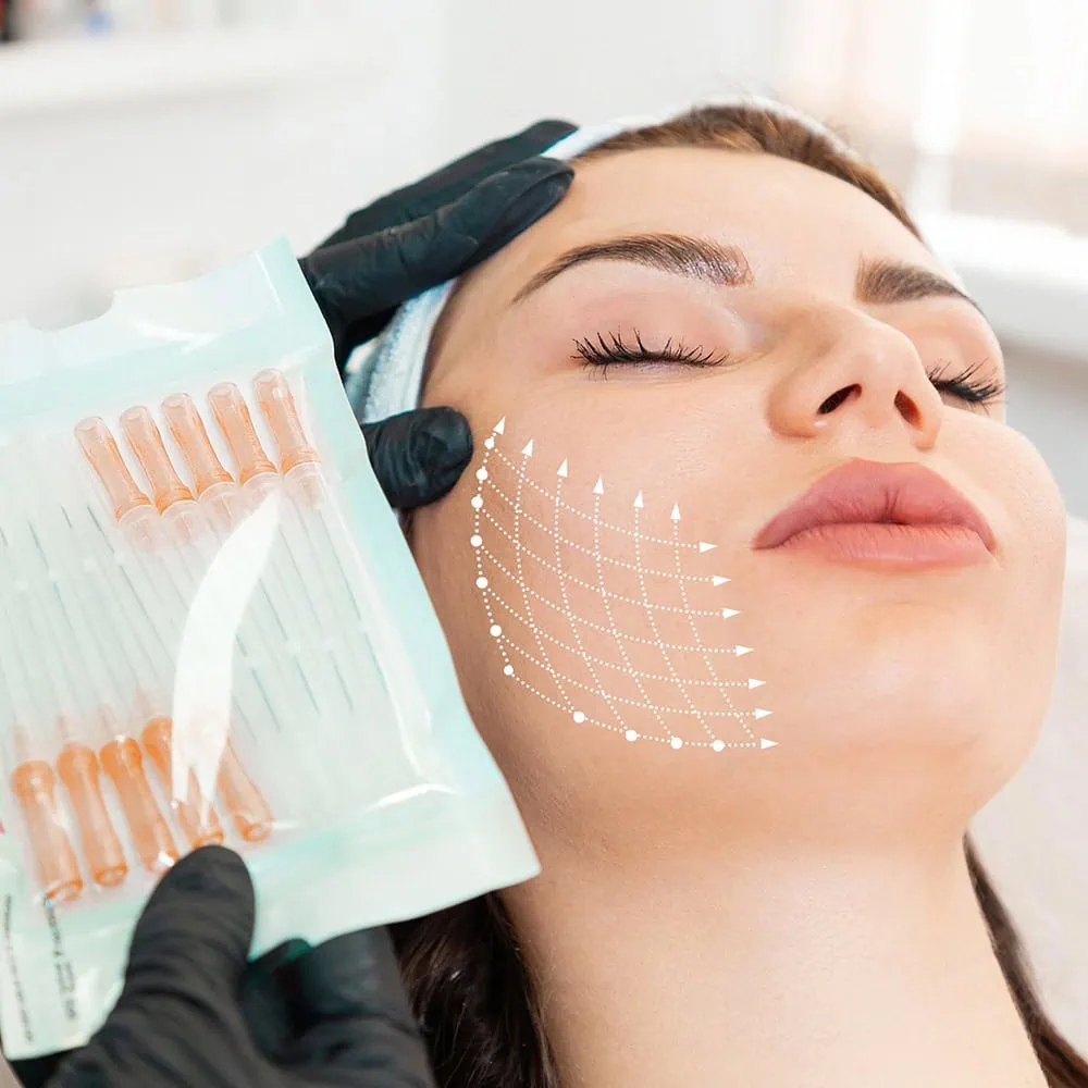 PDO Threads Treatment at Skin MD in Woodstock, GA